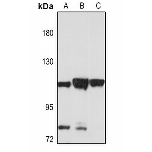 IGHMBP2 Rabbit Polyclonal Antibody