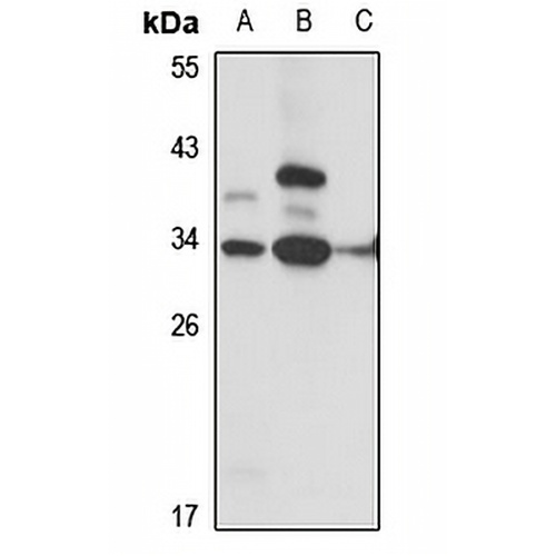 IGSF6 Rabbit Polyclonal Antibody