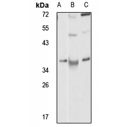 CD210b Rabbit Polyclonal Antibody