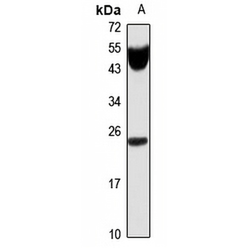 IL-11 Rabbit Polyclonal Antibody