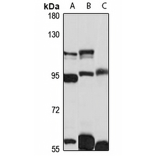 IL1RAPL1 Rabbit Polyclonal Antibody