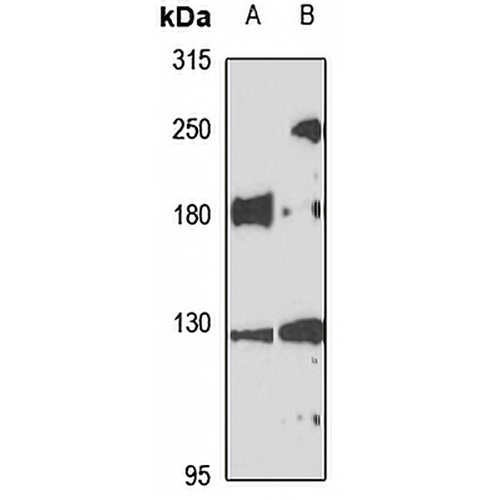INF2 Rabbit Polyclonal Antibody