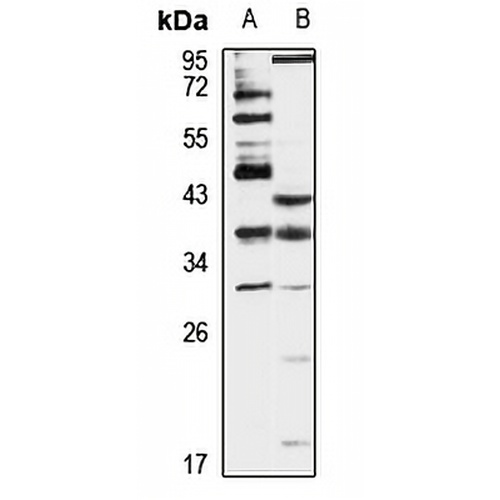 ING2 Rabbit Polyclonal Antibody