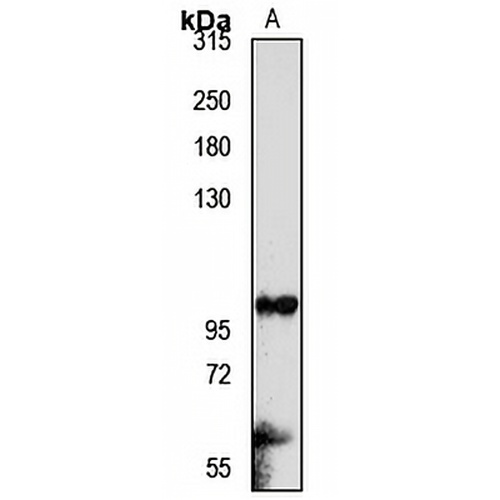 INPP4B Rabbit Polyclonal Antibody