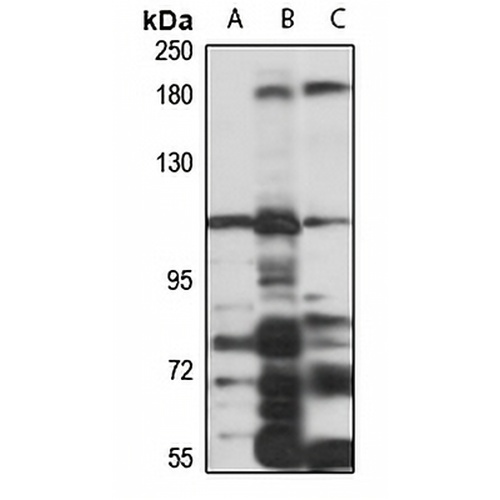 INPP5B Rabbit Polyclonal Antibody