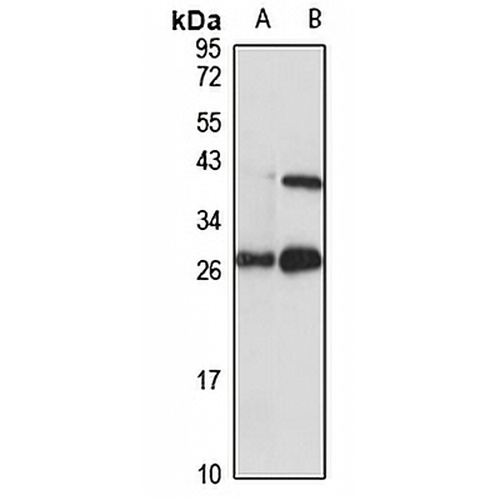 INSIG2 Rabbit Polyclonal Antibody