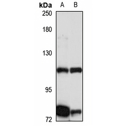 INTS7 Rabbit Polyclonal Antibody