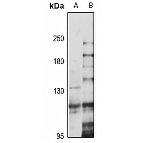 INTS8 Rabbit Polyclonal Antibody