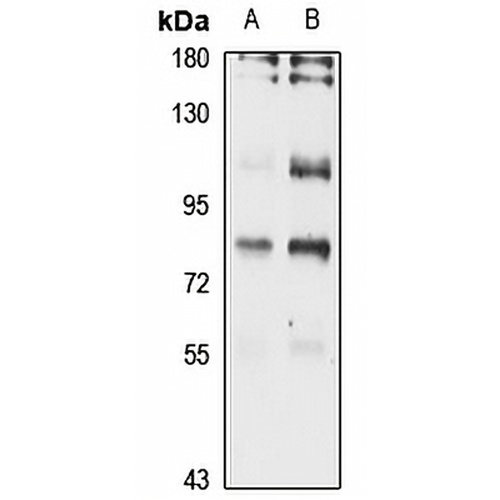 INTS9 Rabbit Polyclonal Antibody