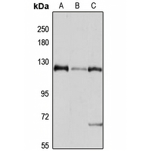 RanBP4 Rabbit Polyclonal Antibody