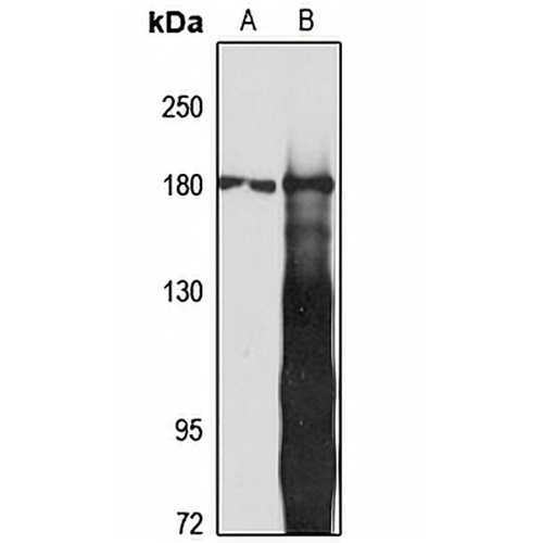 IQGAP2 Rabbit Polyclonal Antibody