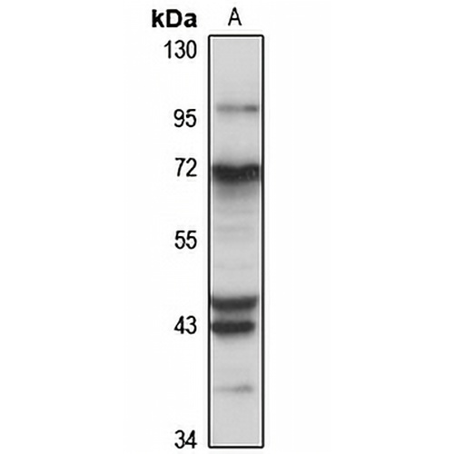 ITCH Rabbit Polyclonal Antibody