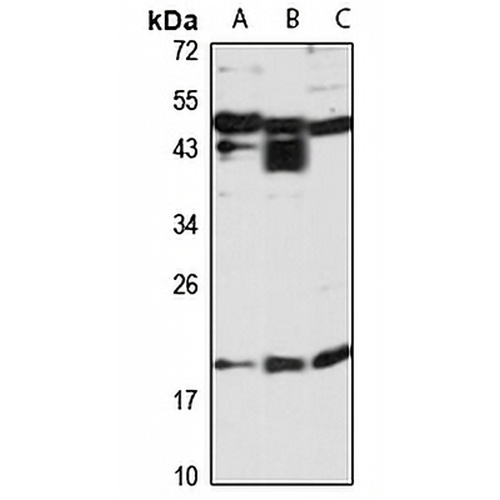 CENPR Rabbit Polyclonal Antibody