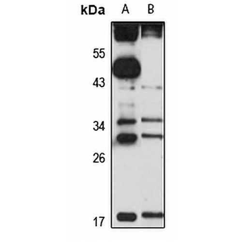 ITM2C Rabbit Polyclonal Antibody