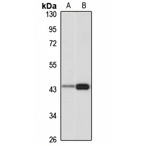IVD Rabbit Polyclonal Antibody