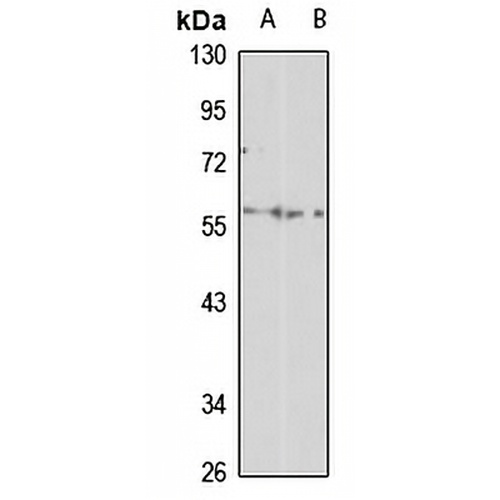 KAT8 Rabbit Polyclonal Antibody