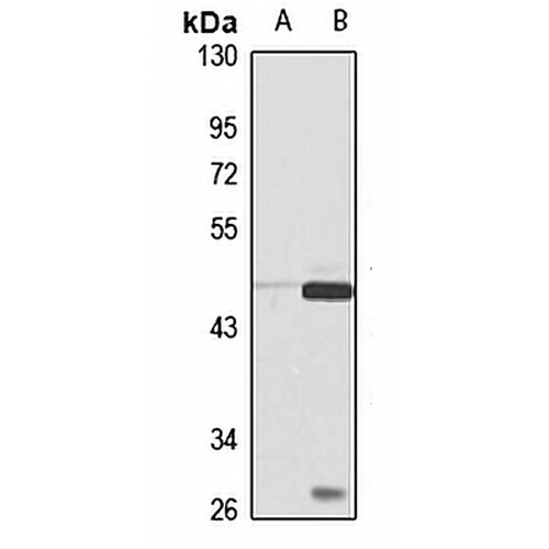 Kir3.2 Rabbit Polyclonal Antibody