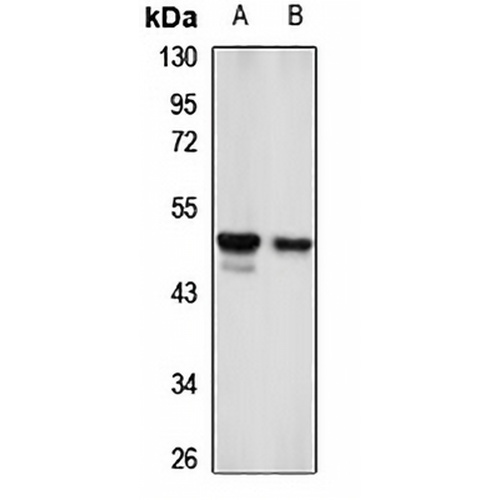 Kir6.1 Rabbit Polyclonal Antibody