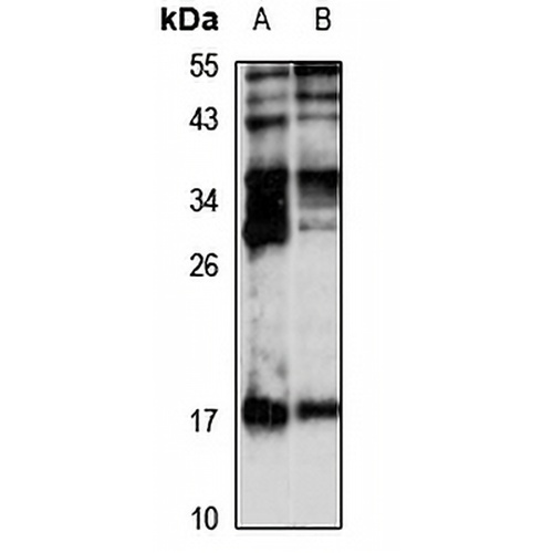 KCNMB1 Rabbit Polyclonal Antibody