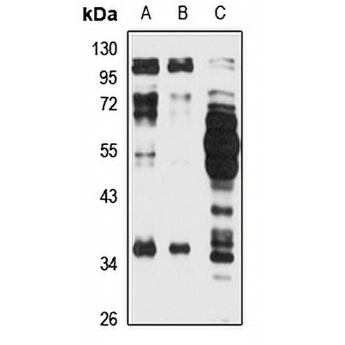 KCTD10 Rabbit Polyclonal Antibody