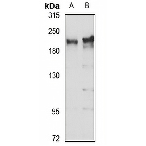 KIAA1429 Rabbit Polyclonal Antibody