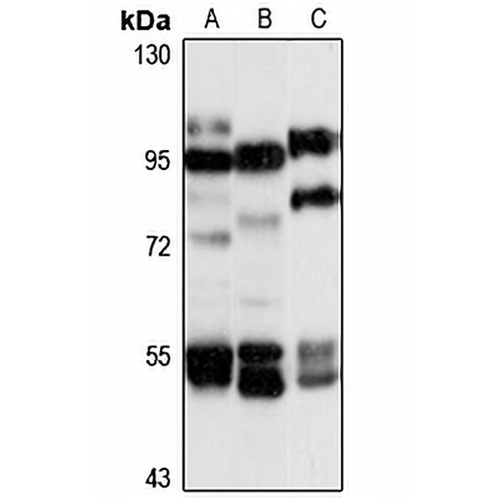 KIF19 Rabbit Polyclonal Antibody