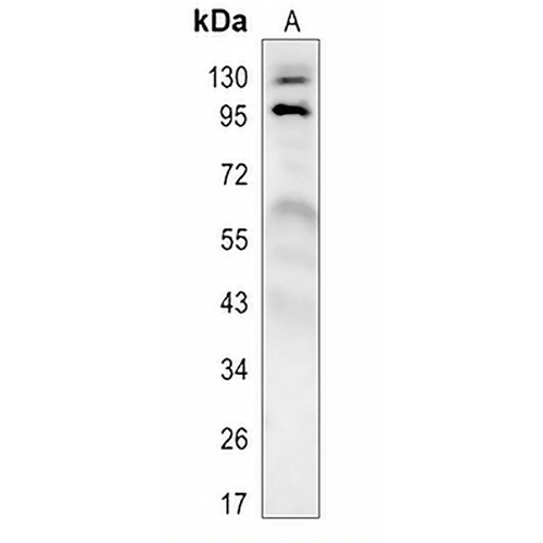 MKLP1 Rabbit Polyclonal Antibody