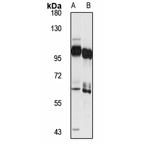KIF3B Rabbit Polyclonal Antibody