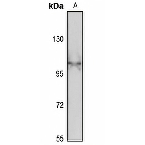 KIF5C Rabbit Polyclonal Antibody