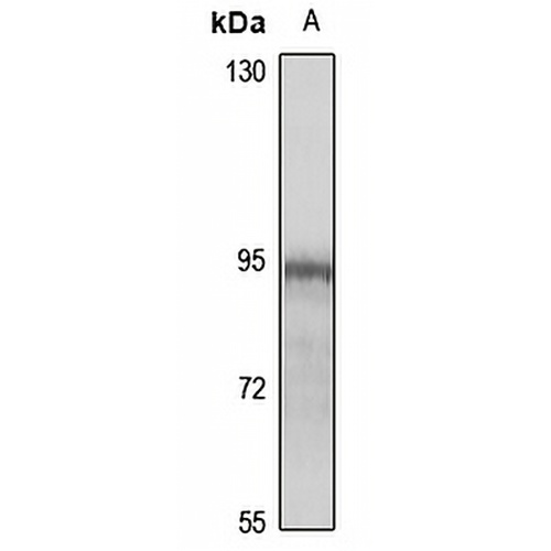 KIF6 Rabbit Polyclonal Antibody