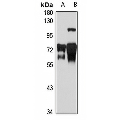 KIFC1 Rabbit Polyclonal Antibody