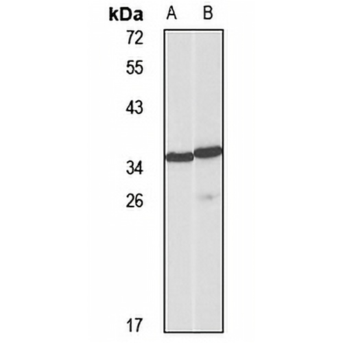 CD158a Rabbit Polyclonal Antibody