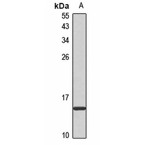 Kisspeptin-1 Rabbit Polyclonal Antibody