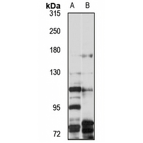 BetaKlotho Rabbit Polyclonal Antibody