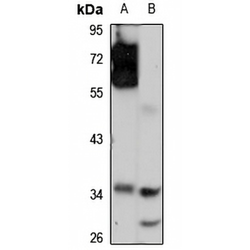 KLF1 Rabbit Polyclonal Antibody