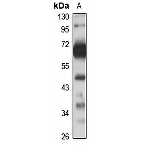 KLF6 Rabbit Polyclonal Antibody