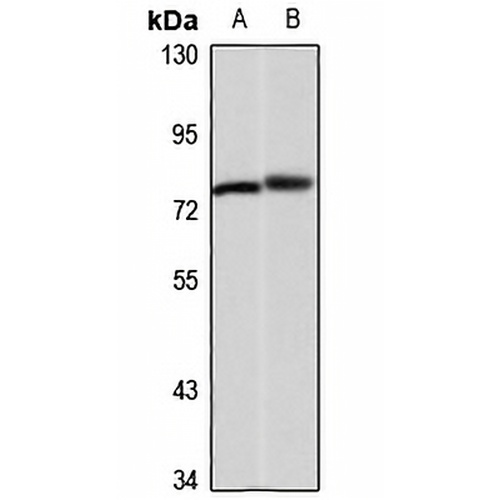 KLHL3 Rabbit Polyclonal Antibody
