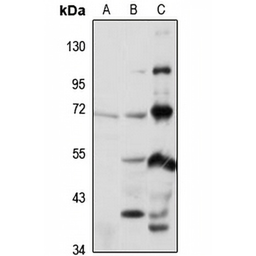 KLHL41 Rabbit Polyclonal Antibody