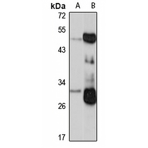 KLK2 Rabbit Polyclonal Antibody