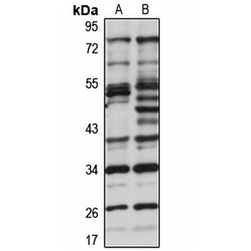 KNSTRN Rabbit Polyclonal Antibody