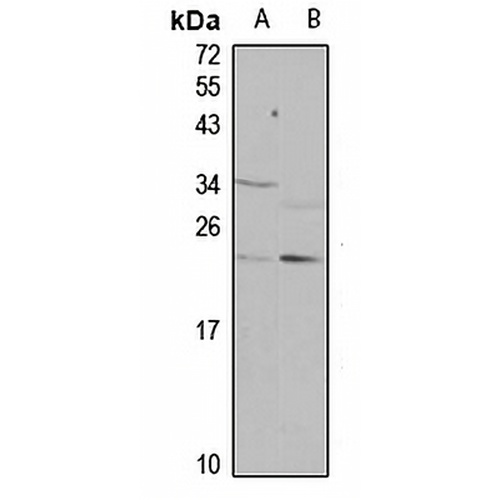 KRBOX4 Rabbit Polyclonal Antibody