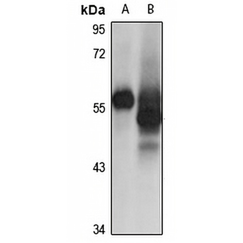 Cytokeratin 12 Rabbit Polyclonal Antibody