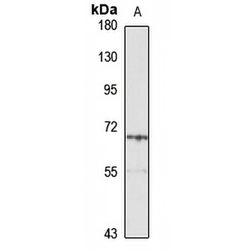 Cytokeratin 3 Rabbit Polyclonal Antibody