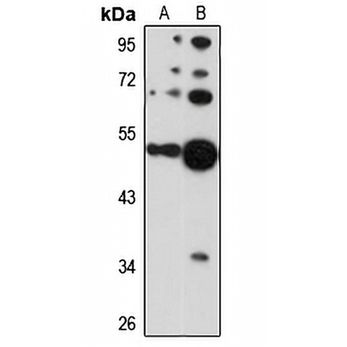 Cytokeratin 36 Rabbit Polyclonal Antibody
