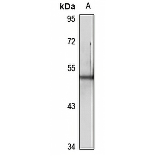Cytokeratin 6A Rabbit Polyclonal Antibody
