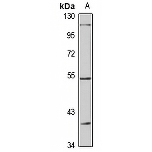 LAD1 Rabbit Polyclonal Antibody