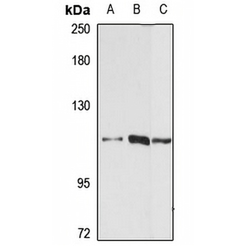 LARP2 Rabbit Polyclonal Antibody