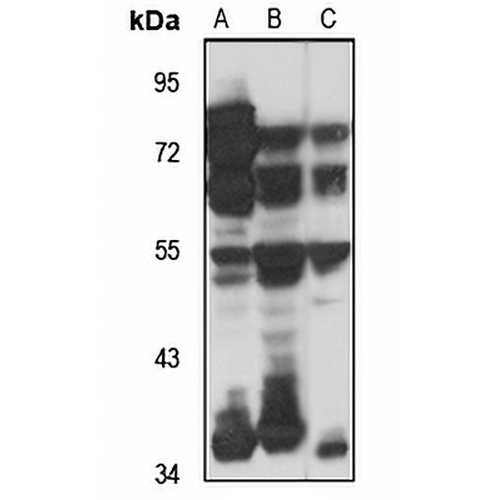 LARP6 Rabbit Polyclonal Antibody