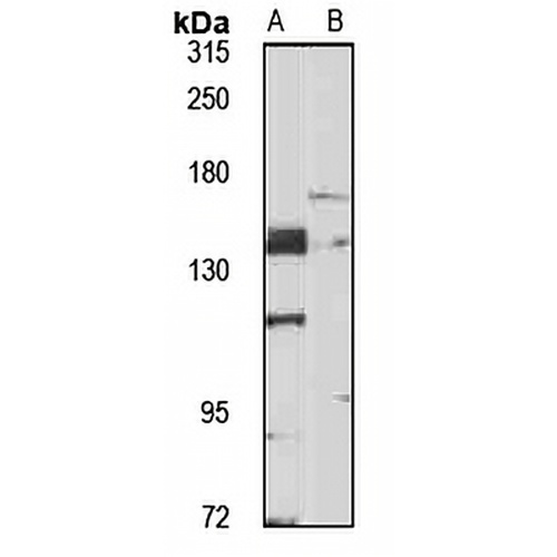 LATS2 Rabbit Polyclonal Antibody