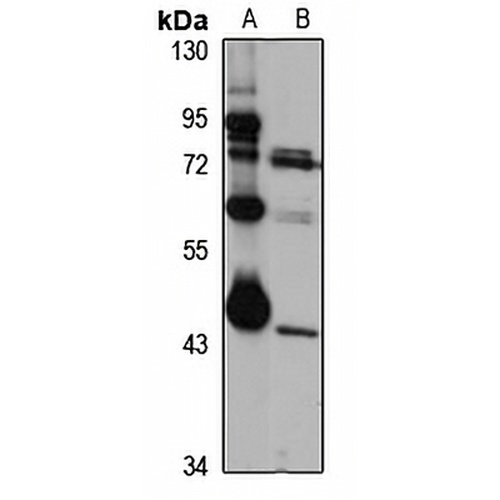 LAX1 Rabbit Polyclonal Antibody